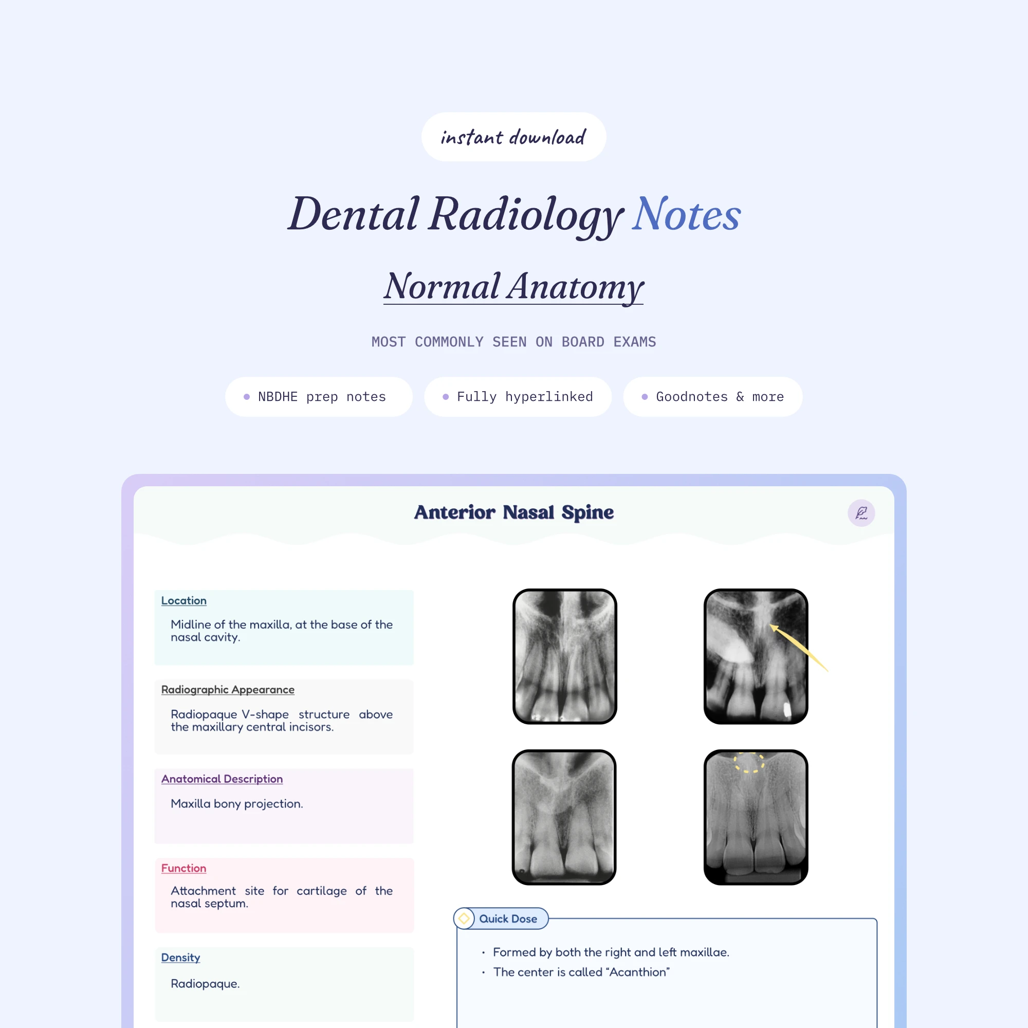 Dental Radiology Notes covering 29 anatomical landmarks, shown on a tablet